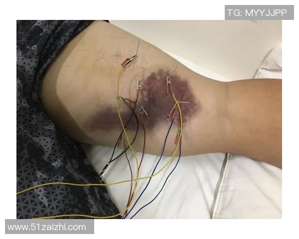 伤病管理与康复策略：探索运动员伤病防治与恢复的综合方法